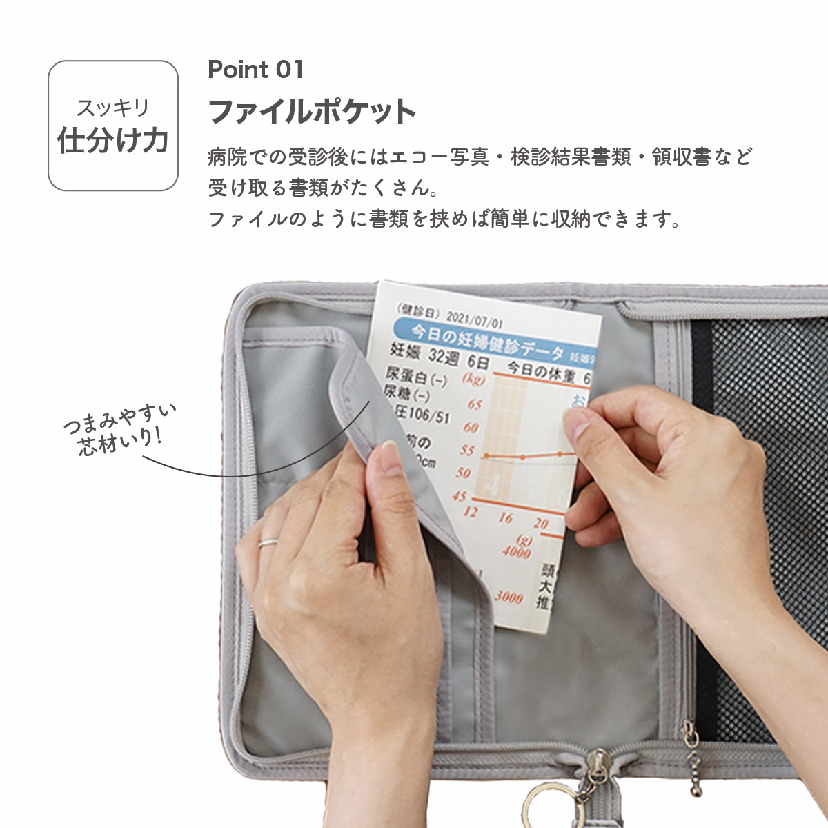 エコー写真 診断結果 領収書